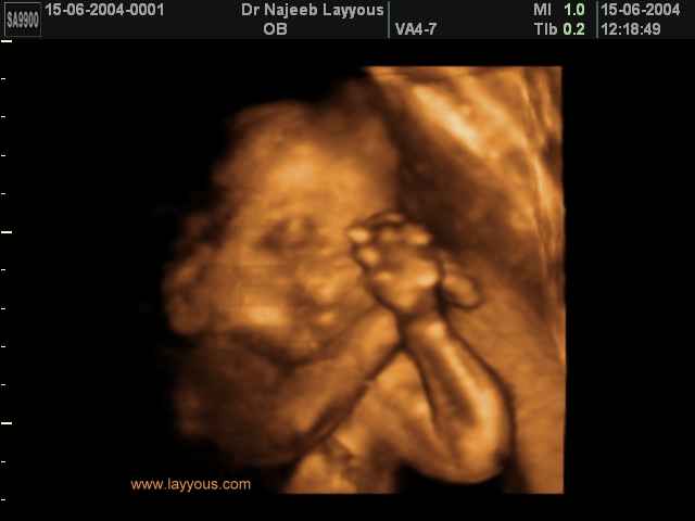 conducting orchestra